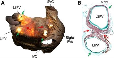 Reassessment of the electrical connection between the pulmonary veins and the left atrium: A study to determine the different contributions of myocardial fibers along the standard ablation circumference